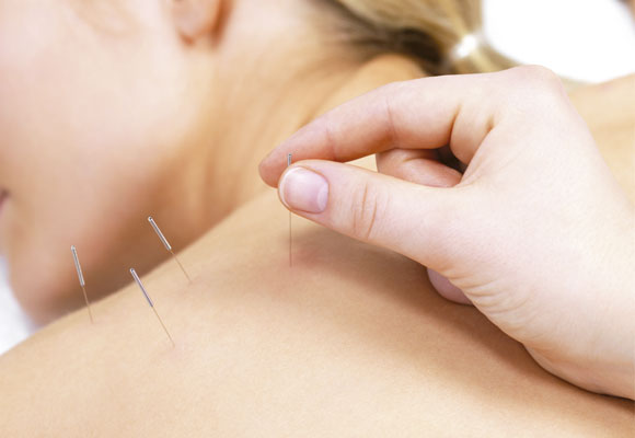 acupuntura - A Dor como o 5° sinal vital
