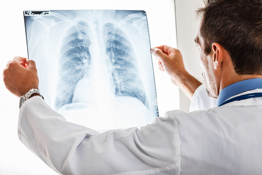 radiografia - Conheça as Posições para Exames