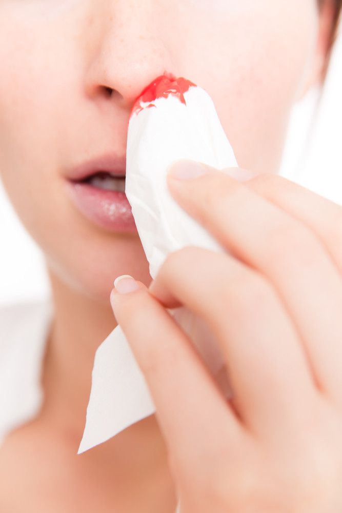 71 sangramento nasal - Termos Técnicos Sistema Respiratório