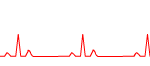 bradicardia sinusal 150x66 - hemostasia