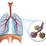 observe desenho esquematico sistema respiratorio com destaque para os alveolos pulmonares 5400ec8803cdd 150x150 - respiratório