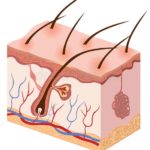pele humana ilustração conservada em estoque 39182020 150x150 - Úlcera