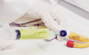 1 300x187 - Como realizar coleta de urina em pacientes sondados