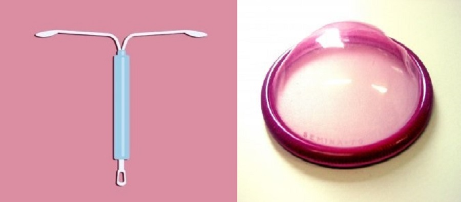 diu contraseptivo 1 - Métodos Contraceptivos: Tipos E Eficácia