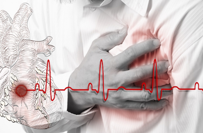 O Que É Parada Cardiorrespiratória? 