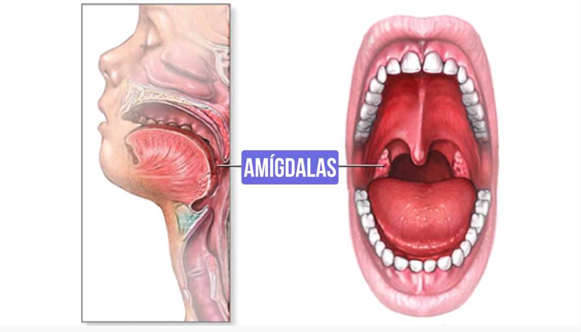 Amigdalas - Sistema Linfático