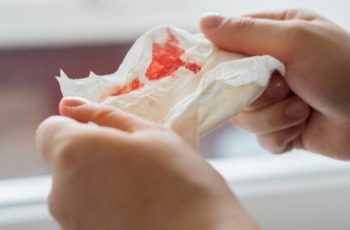 tosse com sangue causas 350x230 - hemorragia capilar
