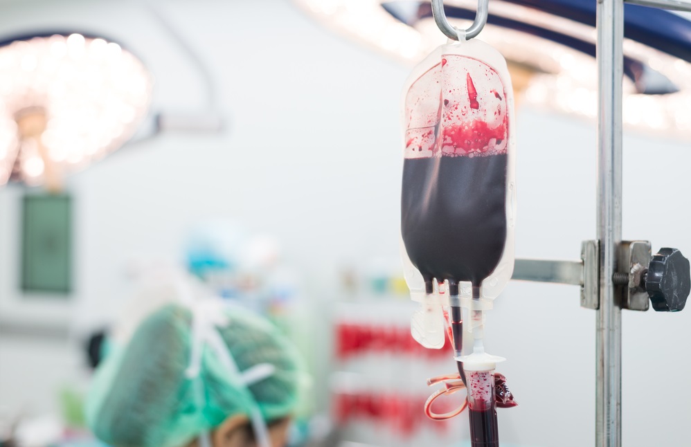 transplante de medula - Hemorragias: O Que Precisamos Saber? 