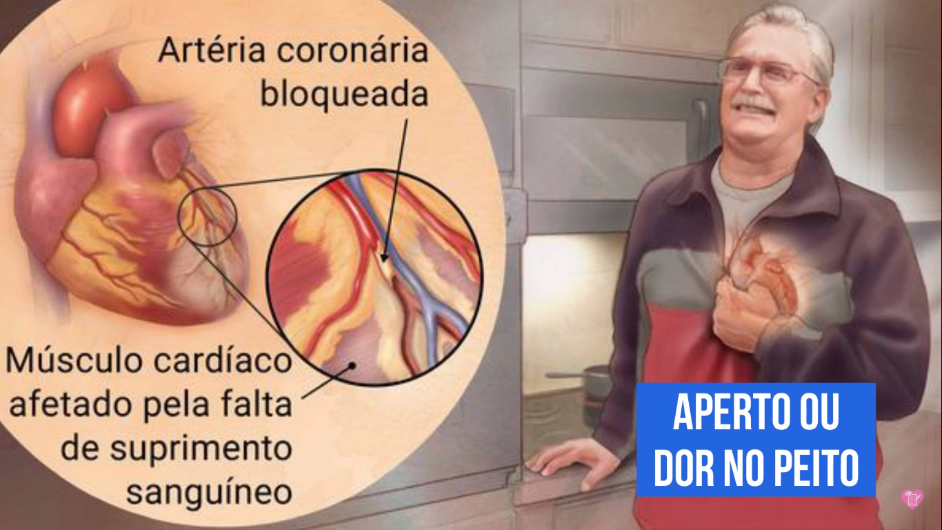 Sintomas do infarto agudo do miocárdio