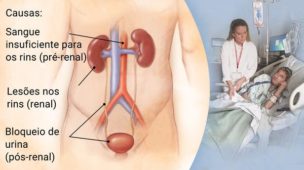 insuficiência renal