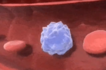 leucemia