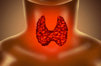 Hipotireoidismo: O Que É E Como Tratar?